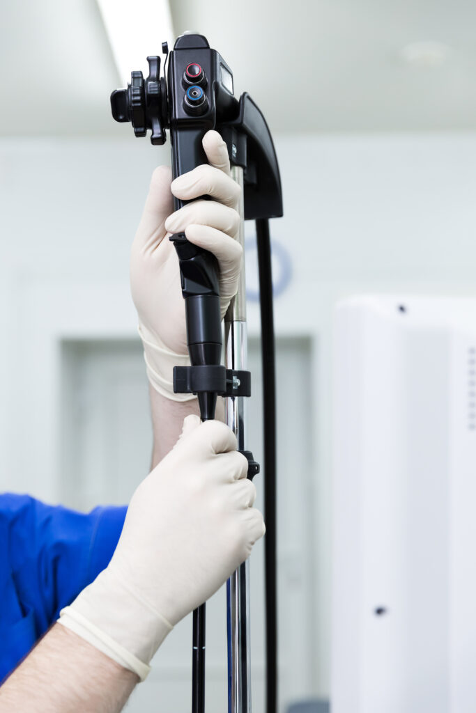 endoscopy test