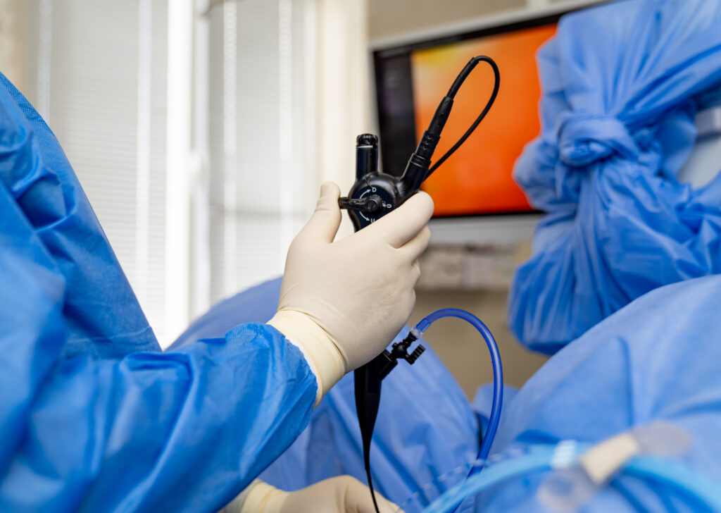 A Simple Guide to Preparing for Your First Endoscopy Test