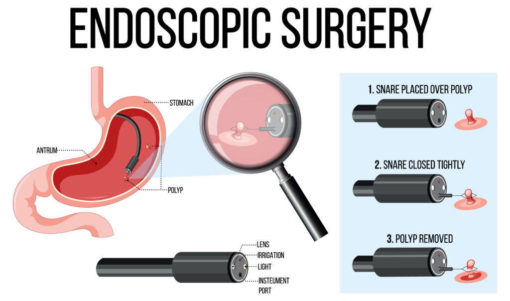 Endoscopy Procedures