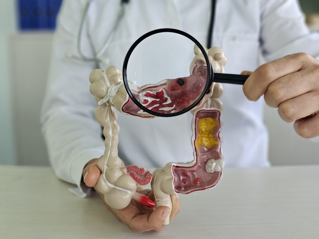 Risks of Colonoscopy You Should Know About