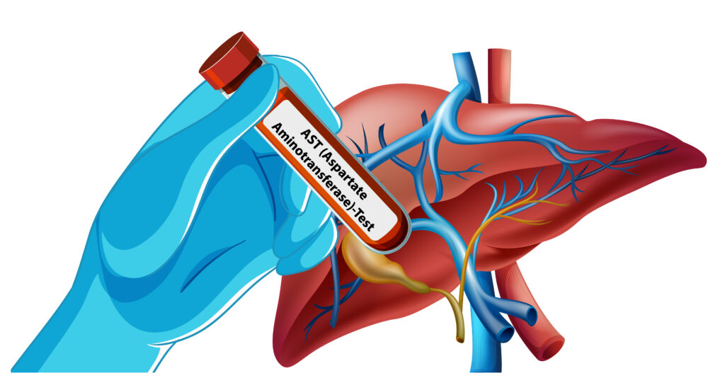 Understanding Liver Function Tests (LFTs): Normal Ranges & What Abnormal Results Mean