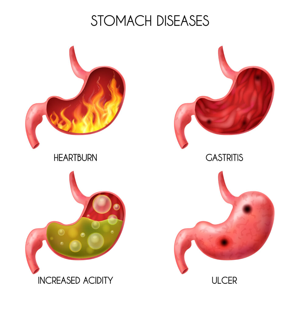 best gastroenterologist
