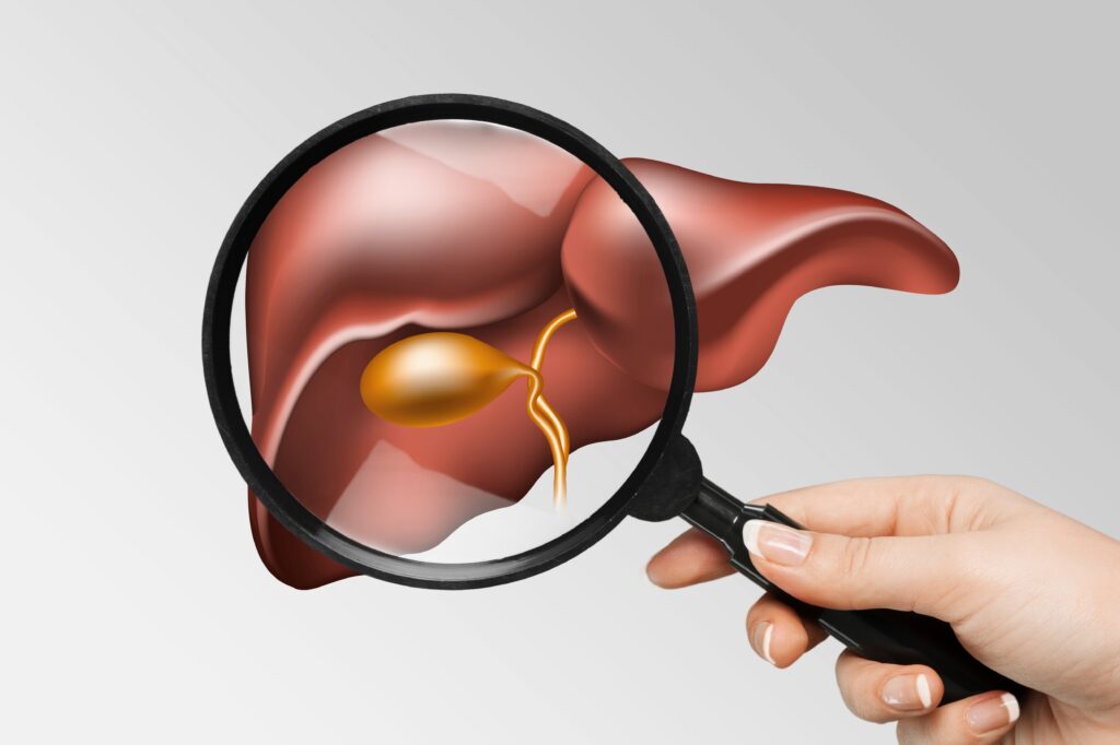 Liver Disease Symptoms: Unexplained Easy Bruising and Bleeding Could Be a Warning Sign