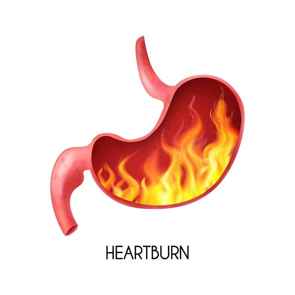 Heartburn