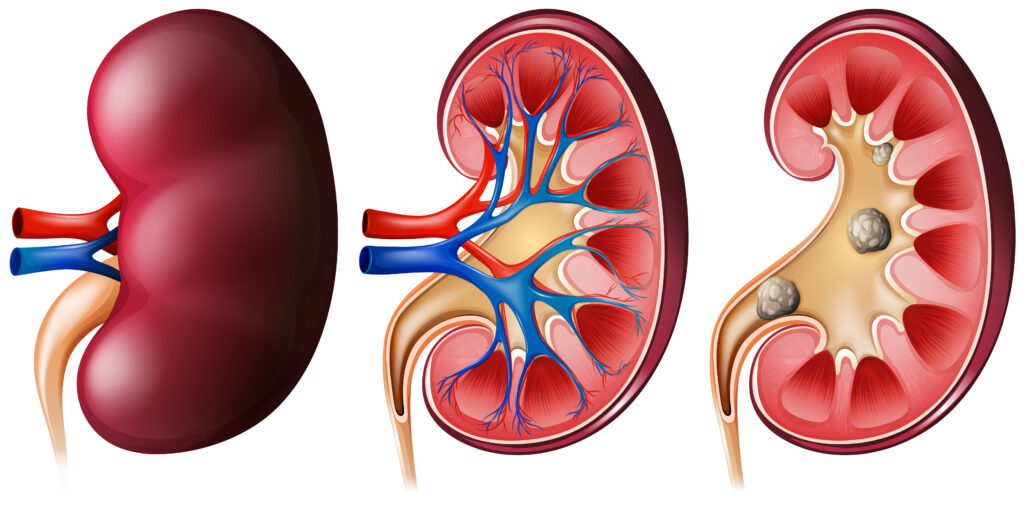 Stomach