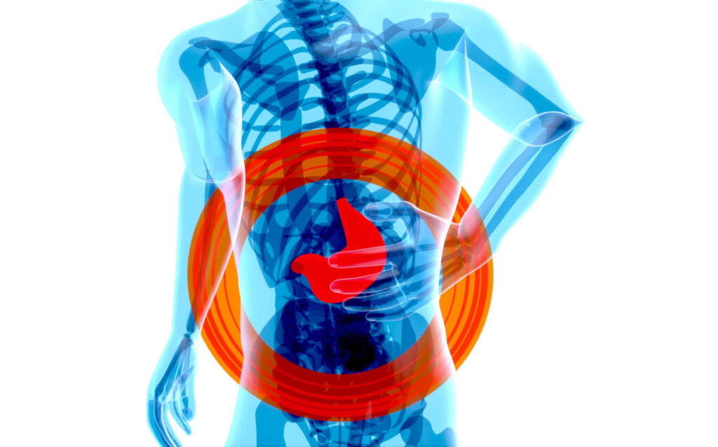 Abdominal Pain