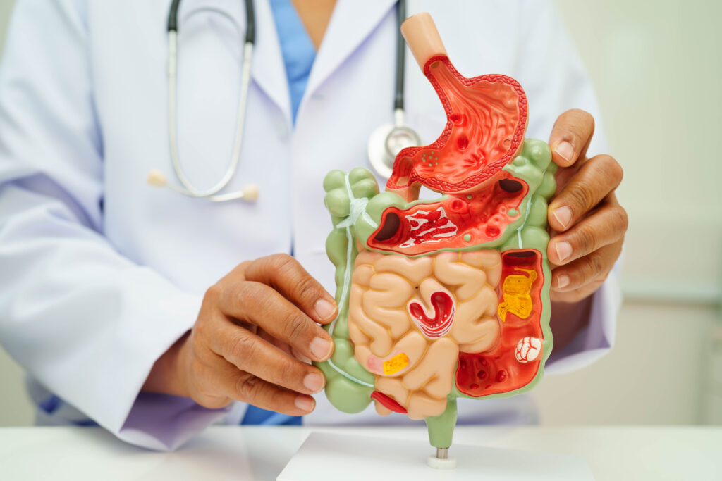 ERCP