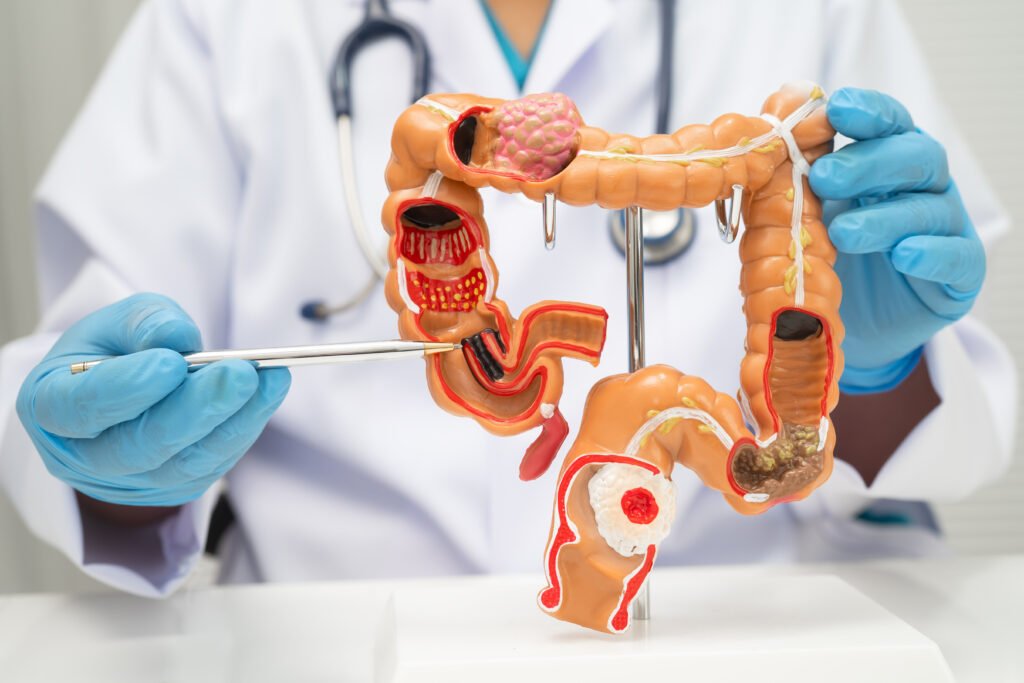 Gastroenterologist