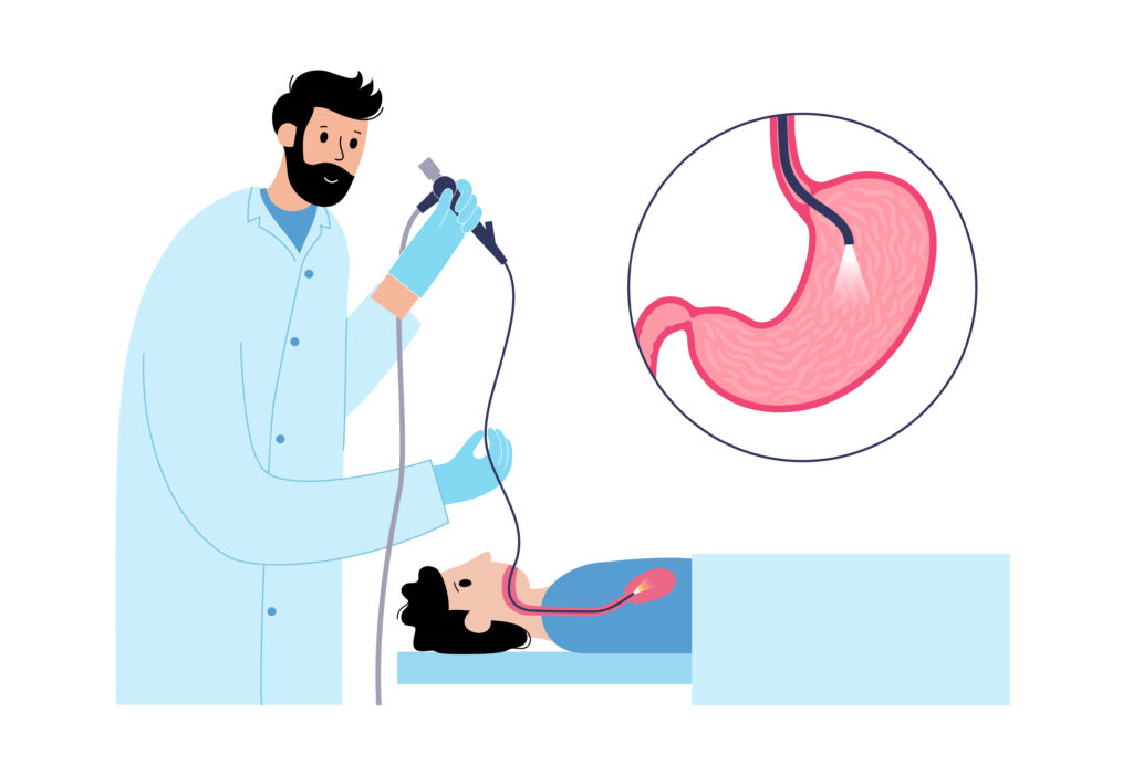Is Endoscopy Painful? A Direct Guide to Sedation and Patient Comfort