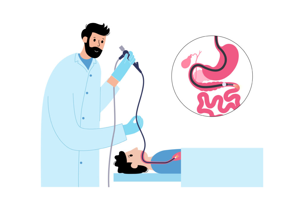 Endoscopy