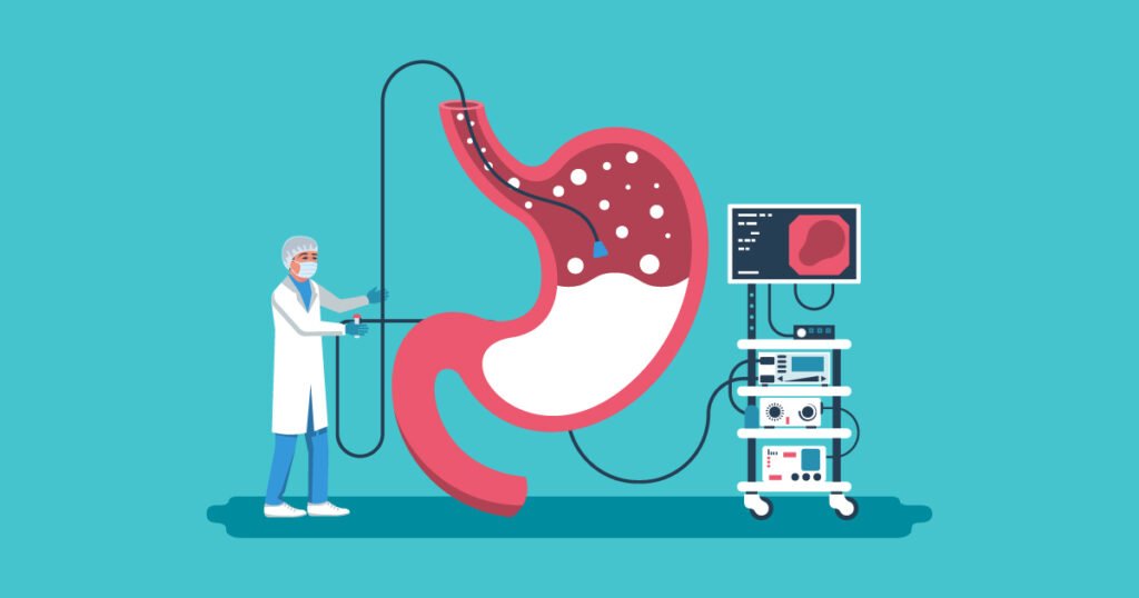 Difficulty Swallowing or Feeling Food Get Stuck? Why You Need an Urgent Gastroscopy Test