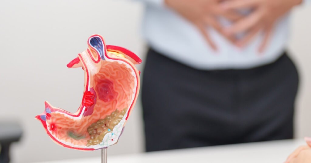 Gastroenterologist
