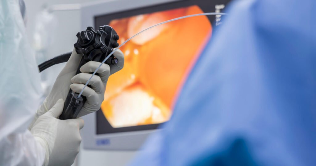 How ERCP Treats Liver and Bile Duct Complications by a Liver Specialist in Lahore